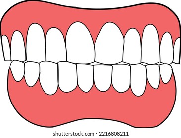 False Teeth Concept Vector Illustration. Dentures. Dental Prosthetic.