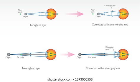 Nearsighted Images Stock Photos Vectors Shutterstock