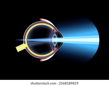 Farsightedness eye disease poster. Hyperopia or long sightedness refractive error concept, problem of blurred vision. Anatomy of human eye, lens and retina, hypermetropia medical vector illustration