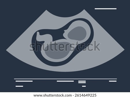 Fascinating glimpse into early pregnancy, showcasing the delicate formation of a fetus within the womb as ultrasound technology unveils the beginning of new life