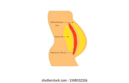 Fat Body Diagram. Human Belly And Abdomen Fat Layer Vector. Location Of Visceral Fat Stored. Human Obesity Side View