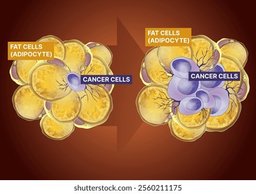 Fat cells, cancer cells. Fat cells Influence tumor. Healthcare illustration. Vector illustration.