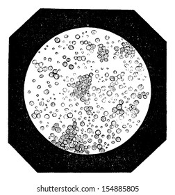 Fat Globules as seen under a Microscope, vintage engraved illustration. Usual Medicine Dictionary by Dr Labarthe - 1885