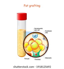 fat grafting structure. Test tube with fat. Close-up of Adipocytes, Fibroblast, Pericyte, Endothelial, and Hematopoietic stem cells. Vector illustration