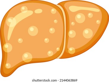 Fat Liver on white background illustration