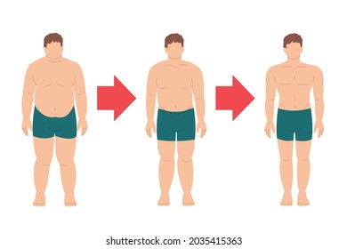 fetter männlicher Patient abnimmt. Vor und nach. Fettleibigkeit, Übergewicht und Diabetes. Sport, Fitness und Diät. Zeitplan, Stufen des Gewichtsverlustes. Drei Leute. Stock-Vektorgrafik auf Weiß.