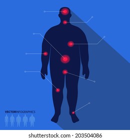 Fat Man Silhouette, Pain Point. Vector Medical Infographics