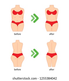 Fat on belly. Tummy before and after diet, fitness or liposuction. Vector illustration of woman belly.