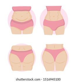 Fat and slim girl, weight loss concept. 