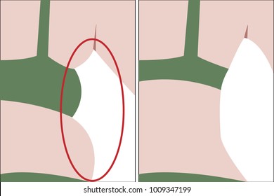 Fat and slim girl's back.  Before and after vector illusstration