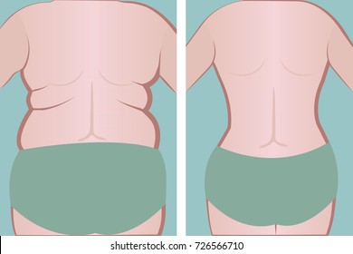 Fat and slim girl's back.  vector illusstration