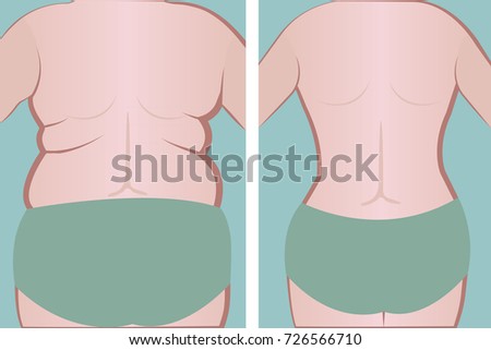Fat and slim girl's back.  vector illusstration