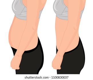 Fat and slim girl's. Fat waist. Liposuction. Before and after. Woman body correction vector illustration