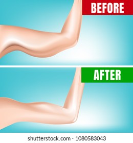 Fat and Slim Hands Before and After Fitness. 3D Vector Illustration. Can use promotion diet and fitness.