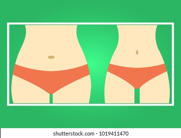 Fat and slim woman figure, before and after weight loss. Female body silhouette. Women waist, weight loss, diet, waistline line icon. Vector illustration