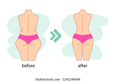 Fat and slim woman figure, before and after weight loss. Women's waist and buttocks weight loss, diet, waistline line icon. Vector illustration.