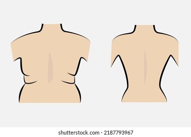 Fat and slim woman's back on gray background. Vector illustration.