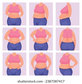 Fat torso. Belly body of fat woman exact vector pictures