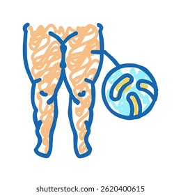 fatty edema doodle icon sketch vector. fatty edema sign. isolated symbol illustration