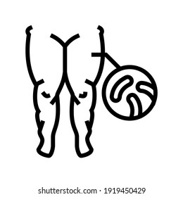 vector de icono de línea de edema graso. signo de edema graso. símbolo de contorno aislado ilustración negra