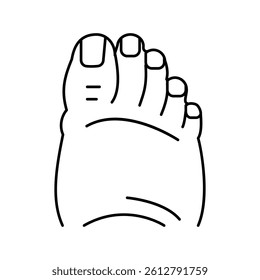 fatty foot edema line icon vector. fatty foot edema sign. isolated contour symbol black illustration