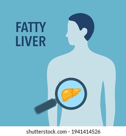 Fatty liver disease vector illustration. Human liver damage in flat design. Healthcare concept.