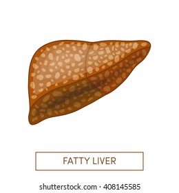 Fatty Liver Disease. Vector Illustration Of A Fatty Liver In Cartoon Style 