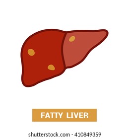 Fatty Liver Disease. Vector Illustration Of A Fatty Liver In Cartoon  Flat Style 