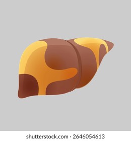 fatty liver, A graphic illustration concept for hepatic steatosis disease, showing an organ with increased fat deposition to highlight potential health problems. Liver disease.