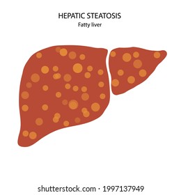 Fatty Liver Logo. Liver Disease, Non Alcoholic Steatohepatitis Concept. Pain And Inflammation In Digestive System. NASH Poster Flat Vector Illustration. Scarring And Damaging In Human Internal Organs.