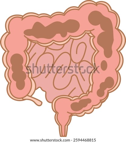 Feces remaining in the entire large intestine