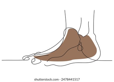 Feet of a man suffering from gout, doodle continuous line art vector illustration