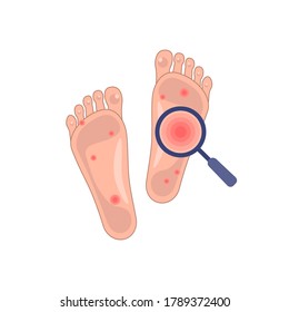 feet with problem skin icon. Representation of a patient’s feet with allergic reaction like dermatitis. Image of skin disease and rash. Symbol for medical sites, apps. simple color sign isolated on white