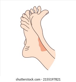 Feet with skin rash psoriasis