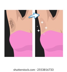 Female armpit hair clean waxing hygiene healthy illustration art icon design vector