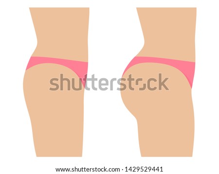 Female ass before and after plastic surgery. Concept of an increase in the buttocks. Vector illustration isolated on white, side view profile.