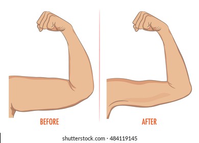 Female biceps before and after sport. Arms showing progress after fitness. Bent arm with bat wing vs well toned arm. Vector illustration for beauty, cosmetology, sport or medicine infographic.
