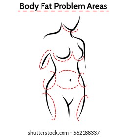 Female body fat problems areas. Vector medical poster with woman silhouette svg
