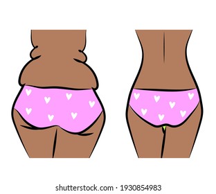 Female body on a white background. Slimming. Cartoon. Vector illustration.