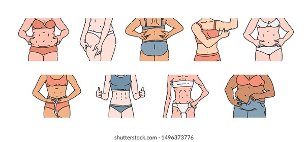 Female body set with different weight and shape, pinching belly fat or leg rolls, measuring waist, fitness and diet difference - hand drawn isolated vector illustration on white backgroun