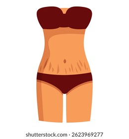 Female body with stretch marks on belly, body positive, self acceptance and skin care concept