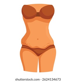 Female body with stretch marks on belly, waist and hips, wearing brown underwear, concept of body positivity, postpartum, weight loss and skin care
