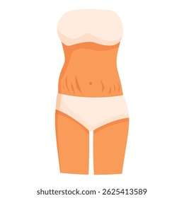 Female body with stretch marks on belly, concept of body positivity, postpartum, pregnancy or weight loss