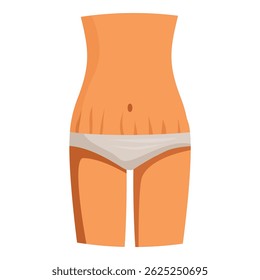 Female body with stretch marks wearing underwear, depicting postpartum or weight loss recovery