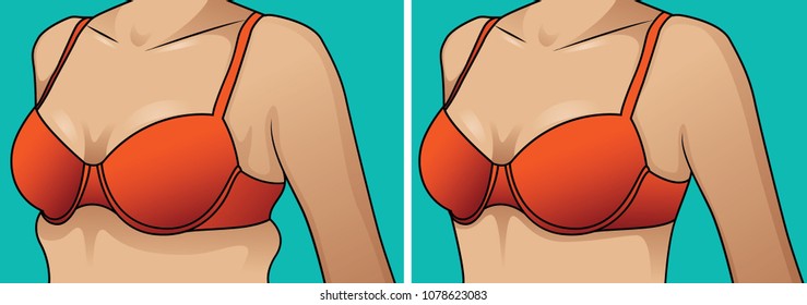 Female  breast. Vector illustration