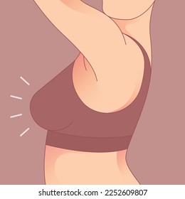 Female breasts in bra after augmentation or breast size correction. woman body shape transformation, Fat To Fit. 