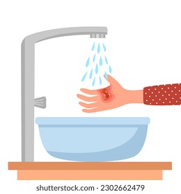 Female burned hand under cool running water in flat design on white background.