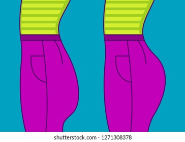 Female buttocks before and after correction of implants, changing shape of bottom with sports exercises, problem of flat ass. Vector illustration