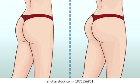 Female buttocks before and after workout. Buttock muscles.