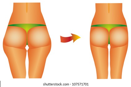 Female buttocks. Diet beauty before after female backside, hips on white background.